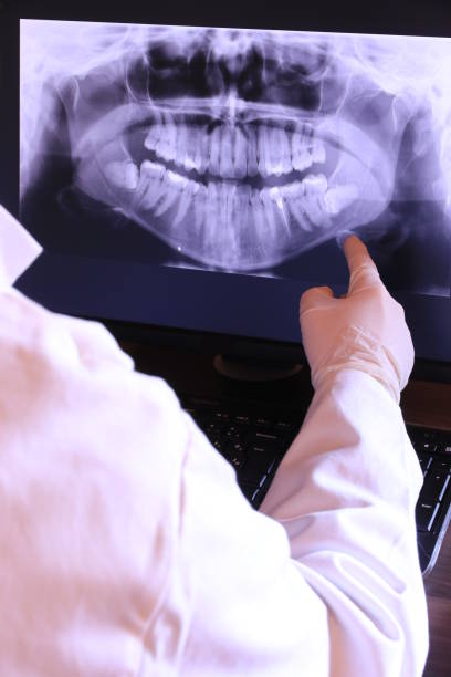 Best Emergency Tooth Extraction in Clayton, NM