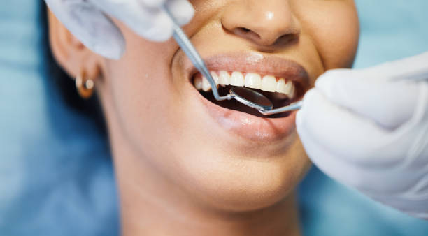 Best Emergency Broken Tooth Repair in Clayton, NM